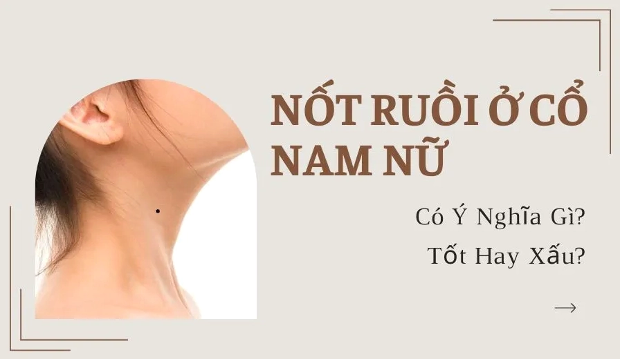 Nốt Ruồi Ở Cổ Là Điềm Lành Hay Xui? Có Nên Xóa Không?