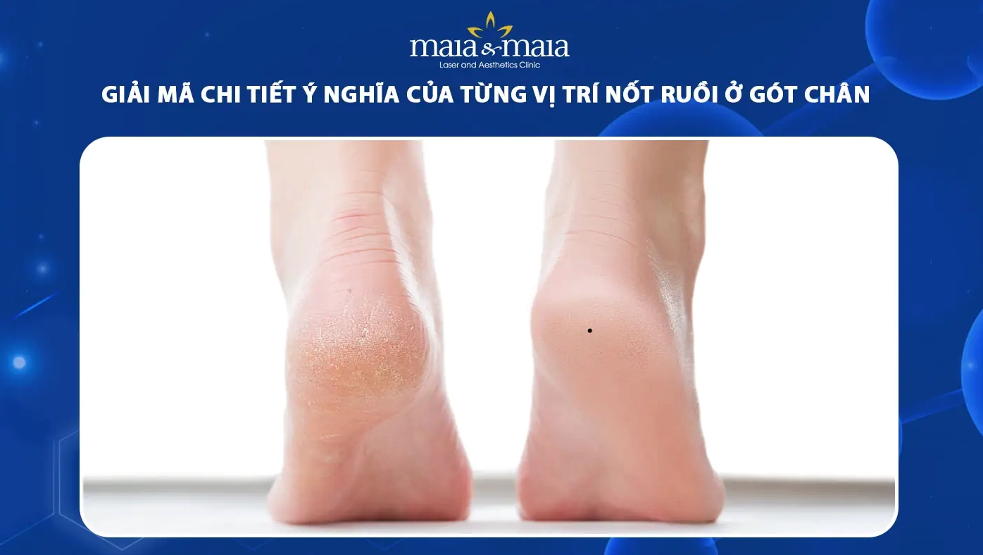 not-ruoi-o-got-chan-giai-ma-van-menh-suc-khoe-va-y-nghia-pho_783