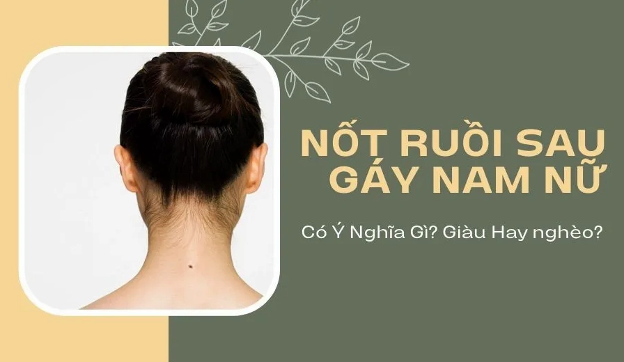 Nốt Ruồi Sau Gáy Nam Nữ Có Ý Nghĩa Gì? Giàu Hay Nghèo?