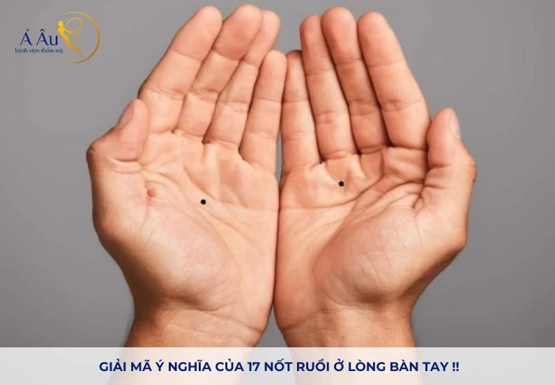 not-ruoi-trong-long-ban-tay-giai-ma-van-menh-tai-loc-doc-dao_154
