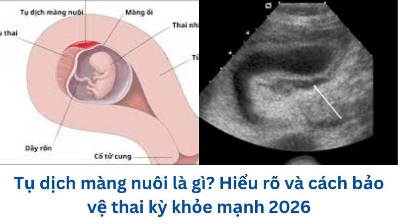 tu-dich-mang-nuoi-la-gi