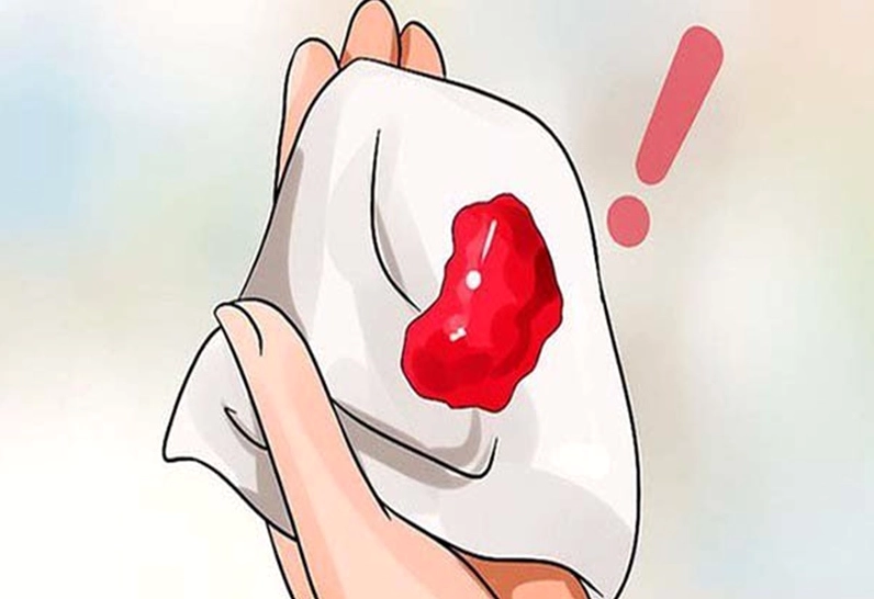 Xuất huyết âm đạo do tụ dịch màng nuôi